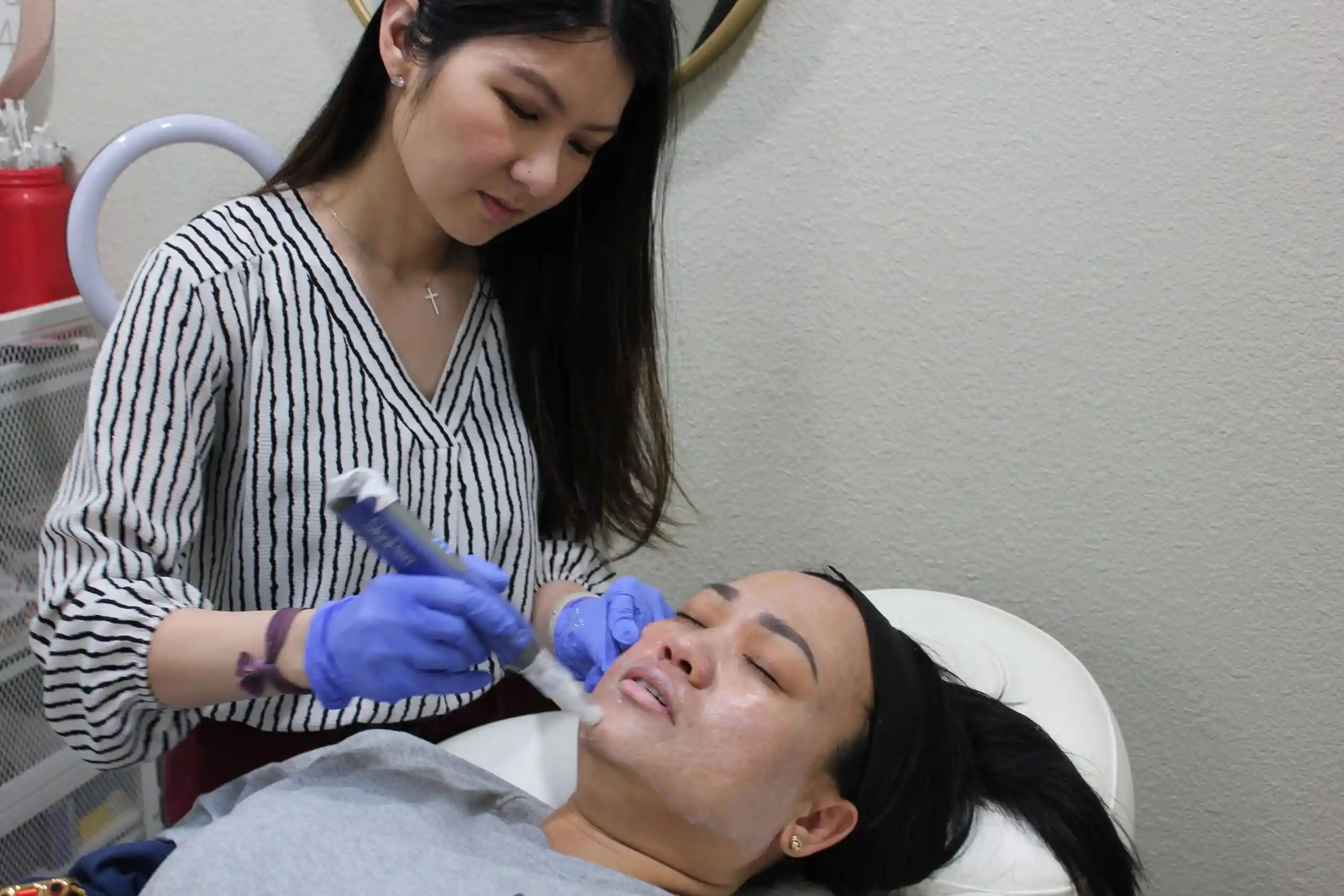 Microneedling